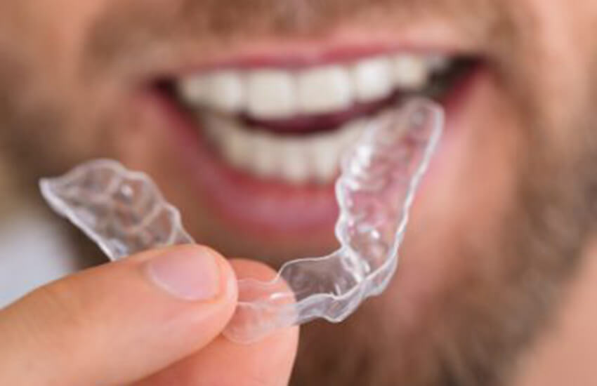Invisalign